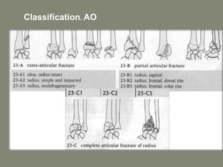 .
Classification. AO
 
