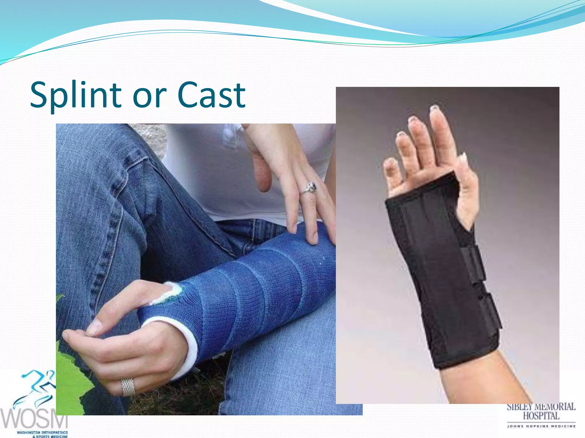 Splint or Cast