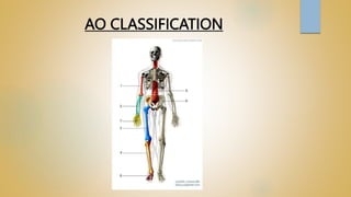 AO CLASSIFICATION
 