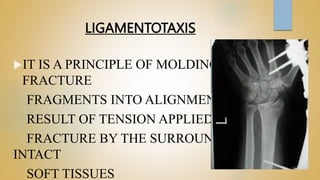 LIGAMENTOTAXIS
IT IS A PRINCIPLE OF MOLDING
FRACTURE
FRAGMENTS INTO ALIGNMENT AS A
RESULT OF TENSION APPLIED ACROSS A
FRACTURE BY THE SURROUNDING
INTACT
SOFT TISSUES
 
