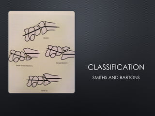 CLASSIFICATION
SMITHS AND BARTONS
 