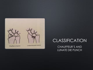 CLASSIFICATION
CHAUFFEUR’S AND
LUNATE DIE PUNCH
 
