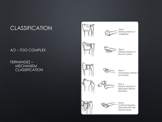 CLASSIFICATION
AO – TOO COMPLEX
FERNANDEZ –
MECHANISM
CLASSIFICATION
 