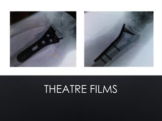 THEATRE FILMS
 