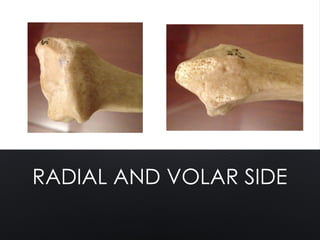 RADIAL AND VOLAR SIDE
 