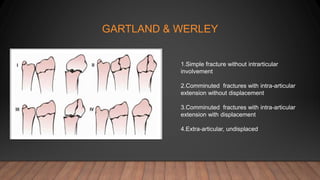 GARTLAND & WERLEY
1.Simple fracture without intrarticular
involvement
2.Comminuted fractures with intra-articular
extension without displacement
3.Comminuted fractures with intra-articular
extension with displacement
4.Extra-articular, undisplaced
 