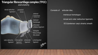 Consists of articular disc,
meniscus homologue
dorsal and volar radioulnar ligament,
ECU(extensor carpi ulnaris) sheath
 