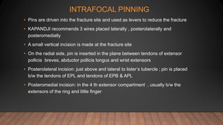 INTRAFOCAL PINNING
• Pins are driven into the fracture site and used as levers to reduce the fracture
• KAPANDJI recommends 3 wires placed laterally , posterolaterally and
posteromedially
• A small vertical incision is made at the fracture site
• On the radial side, pin is inserted in the plane between tendons of extensor
pollicis breves, abductor pollicis longus and wrist extensors
• Posterolateral incision: just above and lateral to lister’s tubercle ; pin is placed
b/w the tendons of EPL and tendons of EPB & APL
• Posteromedial incision: in the 4 th extensor compartment , usually b/w the
extensors of the ring and little finger
 