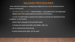 SALVAGE PROCEDURES
when articular congruity or metaphyseal alignment can not be achieved due to
severe comminution
1. DISTRACTION PLATING : internal fixation : using plate from 3 rd metacarpal
distally and to the radial diaphysis proximal to the fracture
- a 12 to 14 holed plate is passed from distal to proximal and distraction force
is applied to the fracture
- plate is then clamped to the proximal radius
-3 screws are used proximally and distally after rdn
- rdn is confirmed by fluoroscopy
-k wires,screws,bone graft, can be used
 