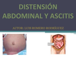 DISTENSIÓN
ABDOMINAL Y ASCITIS
AUTOR: LUIS ROMERO RODRÍGUEZ

 