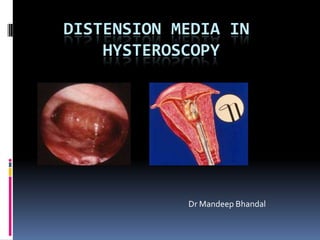 DISTENSION MEDIA IN
    HYSTEROSCOPY




            Dr Mandeep Bhandal
 