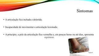 Sintomas
• A articulação fica inchada e dolorida;
• Incapacidade de movimentar a articulação lesionada;
• A princípio, a pele da articulação fica vermelha e, em poucas horas ou até dias, apresenta
equimose.
Raphael
 