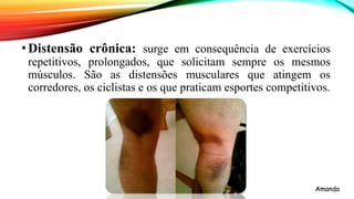 •Distensão crônica: surge em consequência de exercícios
repetitivos, prolongados, que solicitam sempre os mesmos
músculos. São as distensões musculares que atingem os
corredores, os ciclistas e os que praticam esportes competitivos.
Amanda
 