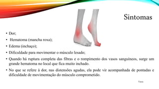 Sintomas
• Dor;
• Hematoma (mancha roxa);
• Edema (inchaço);
• Dificuldade para movimentar o músculo lesado;
• Quando há ruptura completa das fibras e o rompimento dos vasos sanguíneos, surge um
grande hematoma no local que fica muito inchado.
• No que se refere à dor, nas distensões agudas, ela pode vir acompanhada de pontadas e
dificuldade de movimentação do músculo comprometido.
Tássia
 