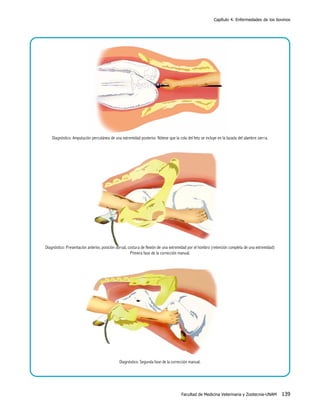 Capítulo 4. Enfermedades de los bovinos

Diagnóstico: Amputación percutánea de una extremidad posterior. Nótese que la cola del feto se incluye en la lazada del alambre sierra.

Diagnóstico: Presentación anterior, posición dorsal, costura de flexión de una extremidad por el hombro (retención completa de una extremidad)
Primera fase de la corrección manual.

Diagnóstico: Segunda fase de la corrección manual.

Facultad de Medicina Veterinaria y Zootecnia-UNAM

139

 