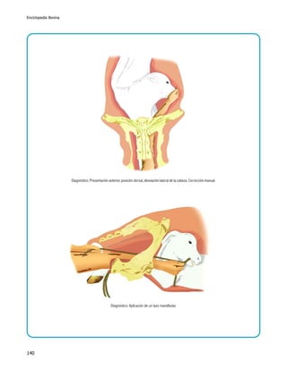 Enciclopedia Bovina

Diagnóstico: Presentación anterior, posición dorsal, desviación lateral de la cabeza. Corrección manual.

Diagnóstico: Aplicación de un lazo mandibular.

140

 