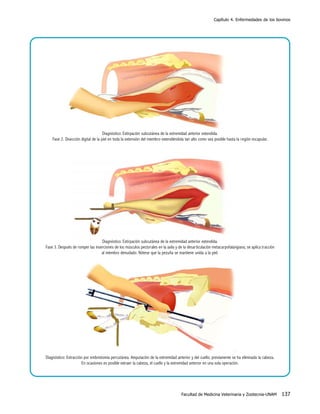 Capítulo 4. Enfermedades de los bovinos

Diagnóstico: Extirpación subcutánea de la extremidad anterior extendida.
Fase 2. Disección digital de la piel en toda la extensión del miembro extendiéndola tan alto como sea posible hasta la región escapular.

Diagnóstico: Extirpación subcutánea de la extremidad anterior extendida.
Fase 3. Después de romper las inserciones de los músculos pectorales en la axila y de la desarticulación metacarpofalangiana, se aplica tracción
al miembro denudado. Nótese que la pezuña se mantiene unida a la piel.

Diagnóstico: Extracción por embriotomía percutánea. Amputación de la extremidad anterior y del cuello; previamente se ha eliminado la cabeza.
En ocasiones es posible extraer la cabeza, el cuello y la extremidad anterior en una sola operación.

Facultad de Medicina Veterinaria y Zootecnia-UNAM

137

 