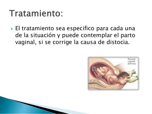 Distocia Materna Y Fetal