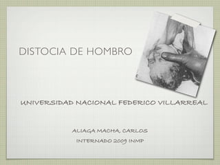 DISTOCIA DE HOMBRO



UNIVERSIDAD NACIONAL FEDERICO VILLARREAL


           ALIAGA MACHA, CARLOS
            INTERNADO 2009 INMP
 
