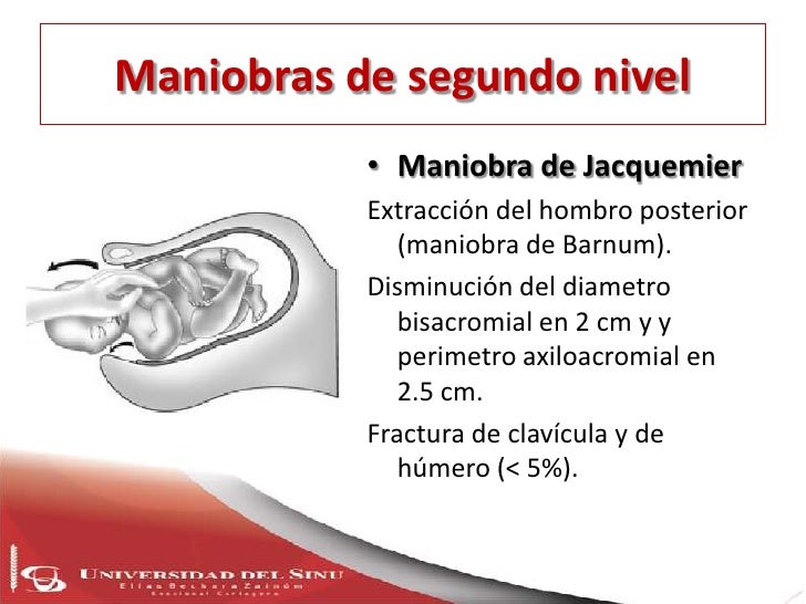 Signo De Jacquemier Chadwick Johnson es.slideshare.net