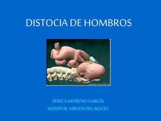 DISTOCIA DE HOMBROS 
ÁFRICA MORENO GARCÍA 
HOSPITAL VIRGEN DEL ROCÍO 
 