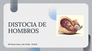 DISTOCIA DE
HOMBROS
IM Flores Cauti, Lady Thalía - UCSUR
 