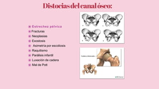 Distociasdelcanalóseo:
⦿ Estrechez pélvica
⦿Fracturas
⦿ Neoplasias
⦿ Exostosis
⦿ Asimetría por escoliosis
⦿ Raquitismo
⦿ Parálisis infantil
⦿ Luxación de cadera
⦿ Mal de Pott
 