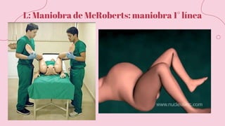 L: Maniobra de McRoberts: maniobra 1° línea
 