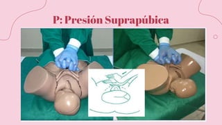P: Presión Suprapúbica
 