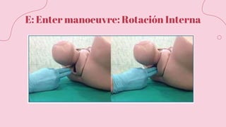 E: Enter manoeuvre: Rotación Interna
 