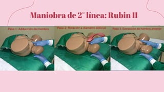 Maniobra de 2° línea: Rubin II
 