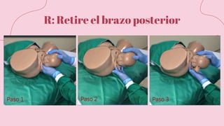R: Retire el brazo posterior
 