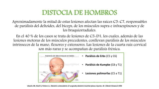 DISTOCIA DE HOMBROS
Aproximadamente la mitad de estas lesiones afectan las raíces C5-C7, responsables
de parálisis del deltoides, del bíceps, de los músculos supra e infraespinosos y de
los braquiorradiales.
En el 40 % de los casos se trata de lesiones de C5-D1, los cuales, además de las
lesiones motoras de los músculos precedentes, conllevan parálisis de los músculos
intrínsecos de la mano, flexores y extensores. Las lesiones de la cuarta raíz cervical
son más raras y se acompañan de parálisis frénica.
Ubachs JM, Sloof A, Petters LL. Obstetric antecedents of surgically obstetric brachial plexus injuries. Br J Obstet Ginaecol 1995
 
