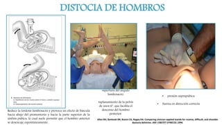 DISTOCIA DE HOMBROS
•apertura del ángulo
lumbosacro.
•aplanamiento de la pelvis
de unos 6º, que facilita el
descenso del hombro
posterior.
• presión suprapúbica
• fuerza en dirección correcta
Reduce la lordosis lumbosacra y provoca un efecto de báscula
hacia abajo del promontorio y hacia la parte superior de la
sínfisis púbica, lo cual suele permitir que el hombro anterior
se desencaje espontáneamente.
Allen RH, Bankoski BR, Butzin CA, Nagey DA. Comparing clinician-applied loands for routine, difficult, and shoulder
dystocia deliviries. AM J OBSTET GYNECOL 1994.
 