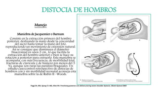 DISTOCIA DE HOMBROS
Manejo
Maniobra de Jacquemier o Barnum
Consiste en la extracción primero del hombro
posterior, deslizando la mano desde la concavidad
del sacro hasta tomar la mano del feto,
reproduciendo un movimiento de extensión natural.
Así se consigue que disminuya el diámetro
bisacromial en unos 2 cm., lo que facilita la
extracción del hombro anterior o bien se hace su
rotación a posterior para extraerlo. Esta maniobra se
acompaña, con más frecuencia, de morbilidad fetal,
fracturas de clavícula y de húmero (en menos del 5
%), aunque son raras las parálisis braquiales. Un
estudio caso/control retrospectivo de distocias de
hombros con y sin morbilidad neonatal aconseja esta
maniobra sobre la de Rubin II –Woods.
Poggi SH, MD, Spong CY, MD, Allen RH. Prioritizing posterior arm delivery during severe shoulder dystocia. Obstet Gynecol 2003
 