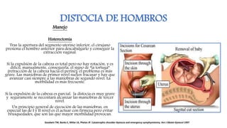 DISTOCIA DE HOMBROS
Manejo
Histerectomía
Tras la apertura del segmento uterino inferior, el cirujano
presiona el hombro anterior para descabalgarlo y conseguir la
extracción vaginal.
Si la expulsión de la cabeza es total pero no hay rotación, y es
difícil, manualmente, conseguirla, el signo de “la tortuga”
(retracción de la cabeza hacia el periné), el problema es más
grave. Las maniobras de primer nivel suelen fracasar y hay que
avanzar casi siempre a las maniobras de segundo nivel. La
morbilidad es más frecuente.
Si la expulsión de la cabeza es parcial, la distocia es muy grave
y seguramente se necesitará alcanzar las maniobras de tercer
nivel.
Un principio general de ejecución de las maniobras, en
especial las de I y II nivel es el actuar con firmeza pero evitar
brusquedades, que son las que mayor morbilidad provocan.
Goodwin TM, Banks E, Millar LK, Phelan JP. Catastrophic shoulder dystocia and emergency symphysiotomy. Am J Obstet Gynecol 1997
 