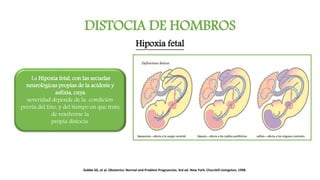 DISTOCIA DE HOMBROS
Hipoxia fetal
La Hipoxia fetal, con las secuelas
neurológicas propias de la acidosis y
asfixia, cuya
severidad depende de la condición
previa del feto, y del tiempo en que trata
de resolverse la
propia distocia.
Gabbe SG, et al. Obstetrics: Normal and Problem Pregnancies. 3rd ed. New York: Churchill Livingston, 1998.
 