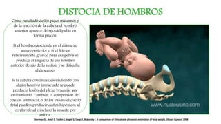 DISTOCIA DE HOMBROS
Como resultado de los pujos maternos y
de la tracción de la cabeza el hombro
anterior aparece debajo del pubis en
forma precoz.
Si el hombro desciende en el diámetro
anteroposterior o si el feto es
relativamente grande para esa pelvis se
produce el impacto de ese hombro
anterior detrás de la sínfisis y se dificulta
el descenso.
Si la cabeza continua descendiendo con
algún hombro impactado se puede
producir lesión del plexo braquial por
estiramiento. También la compresión del
cordón umbilical, o de los vasos del cuello
fetal pueden producir daños hipóxicos al
cerebro fetal e incluso la muerte por
asfixia.
Sherman DJ, Arieli S, Tovbin J, Siegel G, Caspi E, Bukovsky I. A comparison of clinical and ultrasonic estimation of fetal weight. Obstet Gynecol 1998
 