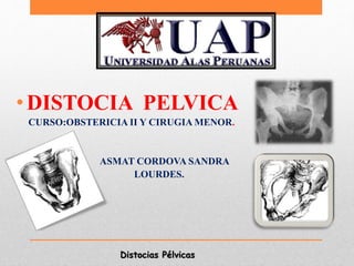 Distocias Pélvicas
•DISTOCIA PELVICA
CURSO:OBSTERICIA II Y CIRUGIA MENOR.
ASMAT CORDOVA SANDRA
LOURDES.
 