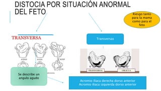DISTOCIA POR SITUACIÓN ANORMAL
DEL FETO
Oblicuas Transversas
Riesgo tanto
para la mama
como para el
feto
La cabeza se situa en una fosa
iliaca, las nalgas en la otra y
uno de los hombros en el
estrecho superior de la pelvis
Acromio iliaca derecha dorso anterior
Acromio iliaca izquierda dorso anterior
Se describe un
angulo agudo
 