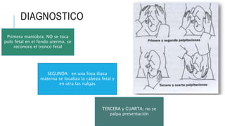 DIAGNOSTICO
Primera maniobra; NO se toca
polo fetal en el fondo uterino, se
reconoce el tronco fetal
SEGUNDA: en una fosa iliaca
materna se localiza la cabeza fetal y
en otra las nalgas
TERCERA y CUARTA; no se
palpa presentación
 