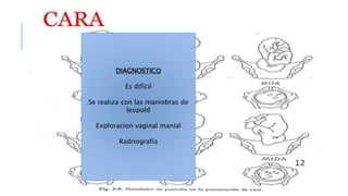 DIAGNOSTICO
Es difícil
Se realiza con las maniobras de
leopold
Exploracion vaginal manial
Radriografia
 