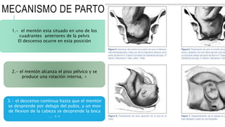 MECANISMO DE PARTO
1.- el mentón esta situado en uno de los
cuadrantes anteriores de la pelvis
El descenso ocurre en esta posición
2.- el mentón alcanza el piso pélvico y se
produce una rotación interna, +
3.- el descenso continua hasta que el mentón
se desprende por debajo del pubis, y un mov
de flexion de la cabeza se desprende la boca
… ++
 