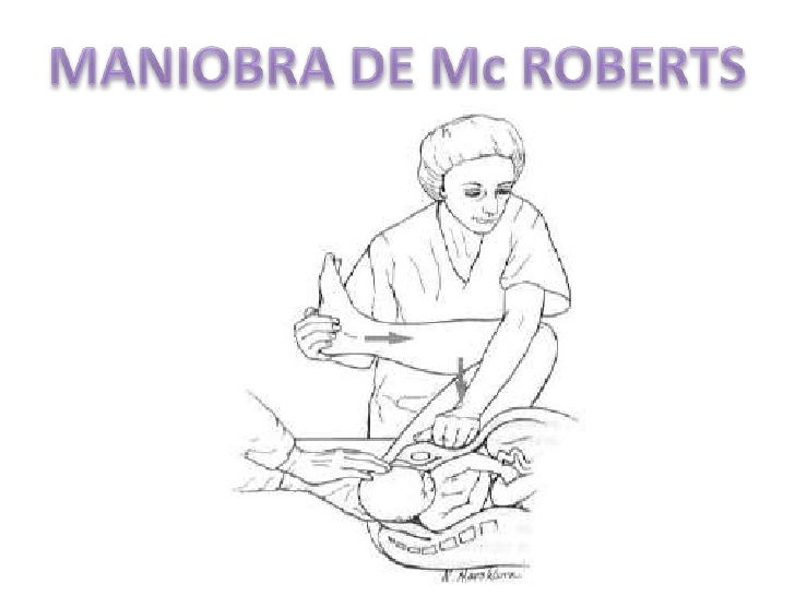 Distocias