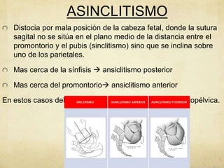 Distocias fetales PPTX distocias-fetales-pptx
