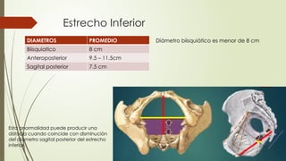 Estrecho Inferior
DIAMETROS PROMEDIO
Biisquiatico 8 cm
Anteroposterior 9.5 – 11.5cm
Sagital posterior 7.5 cm
Esta anormalidad puede producir una
distocia cuando coincide con disminución
del diámetro sagital posterior del estrecho
inferior.
Diámetro biisquiático es menor de 8 cm
 