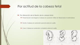 Por actitud de la cabeza fetal
 Por alteración de la flexión de la cabeza fetal.
 Presentación de bregma: Cabeza en posición militar sin flexionarse ni extenderse
 Frente: Cabeza en extensión parcial sobre el cuello
 Cara: Cabeza en extensión completa sobre el cuello
 