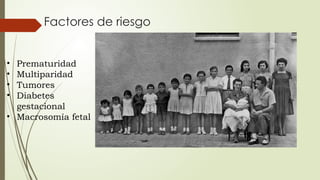 • Prematuridad
• Multiparidad
• Tumores
• Diabetes
gestacional
• Macrosomía fetal
Factores de riesgo
 