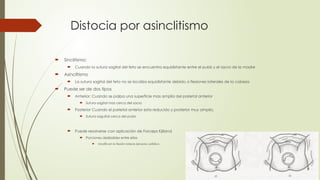 Distocia por asinclitismo
 Sinclitismo:
 Cuando la sutura sagital del feto se encuentra equidistante entre el pubis y el sacro de la madre
 Asinclitismo
 La sutura sagital del feto no se localiza equidistante debido a flexiones laterales de la cabeza
 Puede ser de dos tipos
 Anterior: Cuando se palpa una superficie mas amplia del parietal anterior
 Sutura sagital mas cerca del sacro
 Posterior Cuando el parietal anterior esta reducido y posterior muy amplio,
 Sutura saguital cerca del pubis
 Puede resolverse con aplicación de Forceps Kjilland
 Porciones deslizables entre ellas
 Modifican la flexión lateral del polo cefálico
 