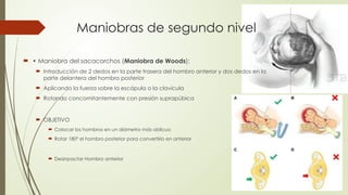 Maniobras de segundo nivel
 • Maniobra del sacacorchos (Maniobra de Woods):
 Introducción de 2 dedos en la parte trasera del hombro anterior y dos dedos en la
parte delantera del hombro posterior
 Aplicando la fuerza sobre la escápula o la clavícula
 Rotando concomitantemente con presión suprapúbica
 OBJETIVO
 Colocar los hombros en un diámetro más oblicuo
 Rotar 180º el hombro posterior para convertirlo en anterior
 Desinpactar Hombro anterior
 